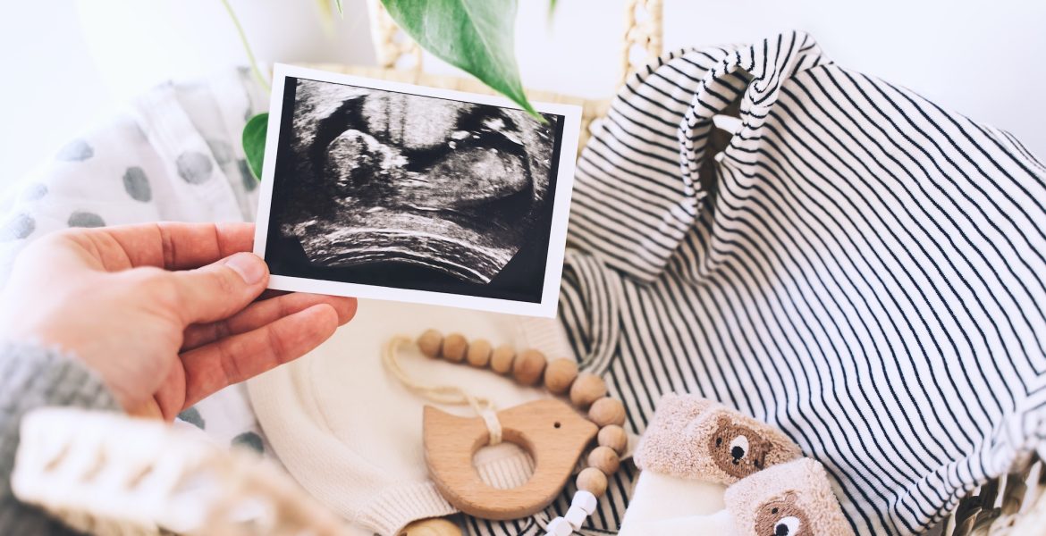Woman's hand holding ultrasound images in background of wicker basket of stuff for newborn baby.